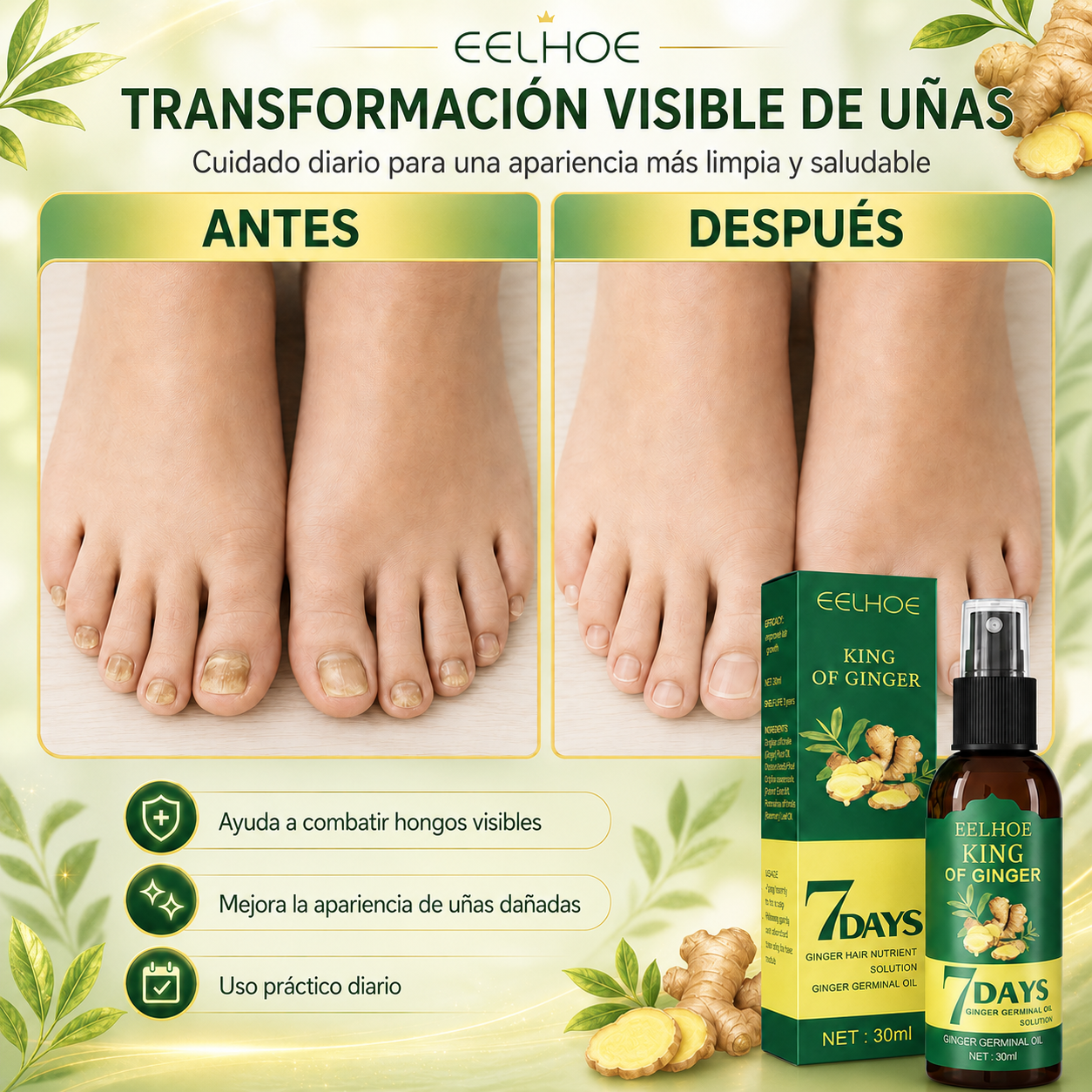 7 Days Fungus Free Nails® | Protege y elimina el hongo de tus Uñas
