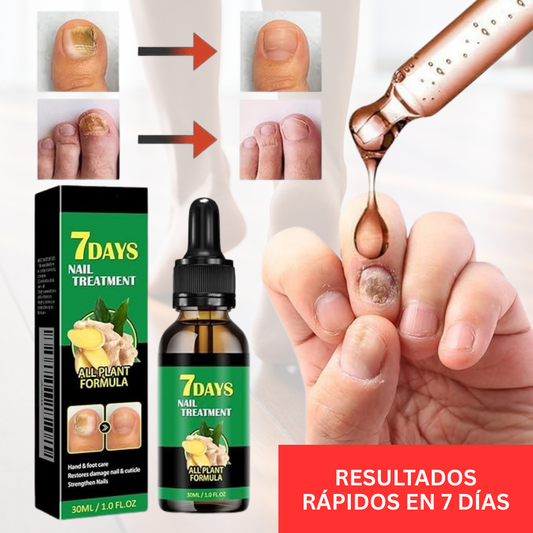7 Days Fungus Free Nails® | Protege y elimina el hongo de tus Uñas